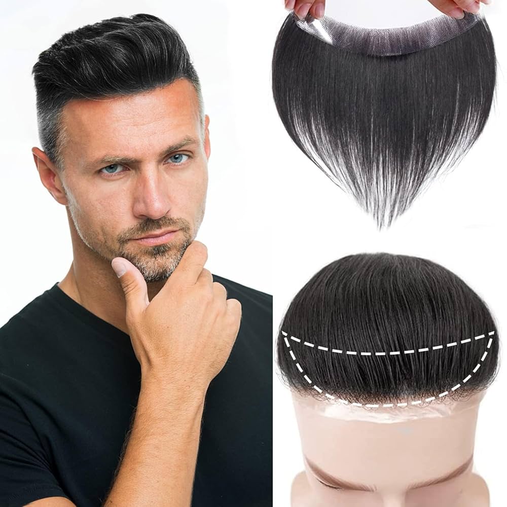 best hair systems for men