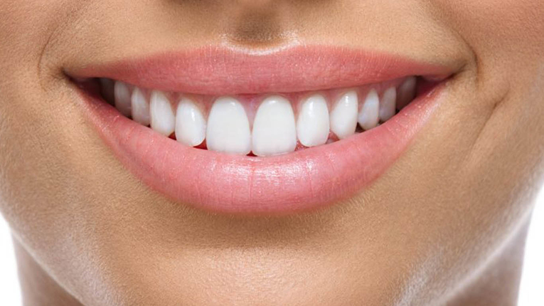 Reveal Radiant Teeth Smoothly Using Teeth Whitening Cost Tips