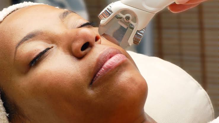 Smooth glow energy unlock Laser Skincare Treatments skin shine